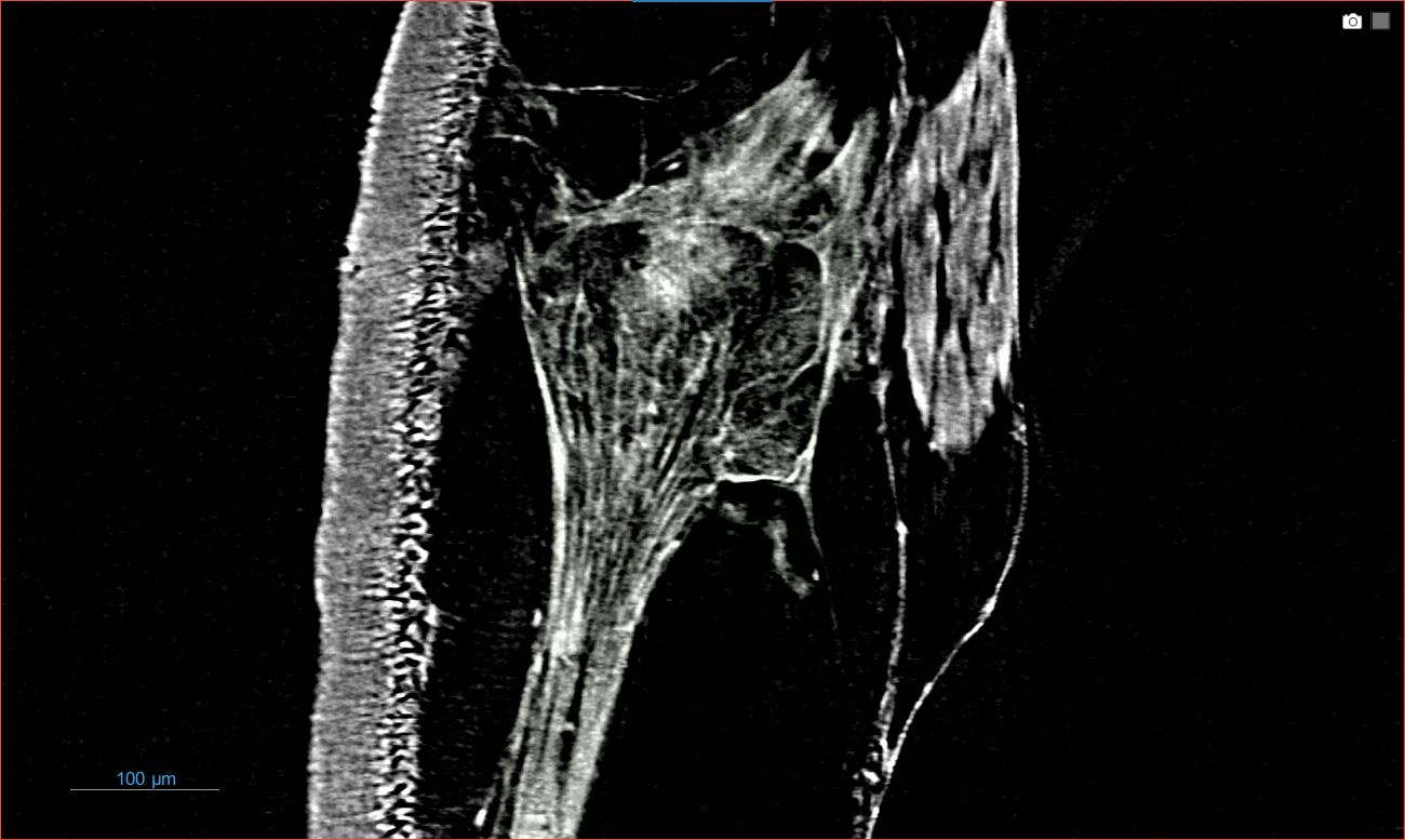 IMAGE - 11652